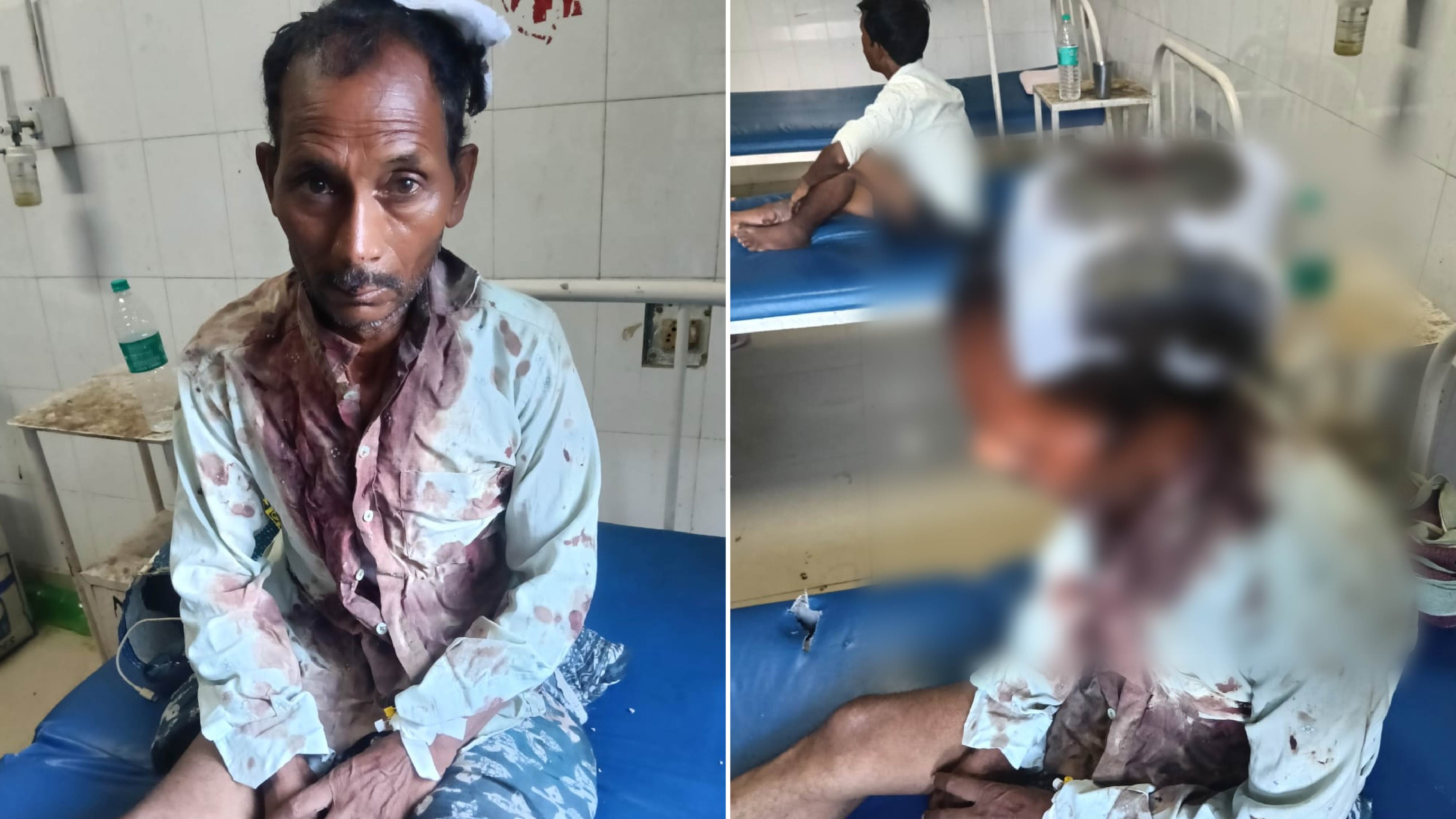 फर्रुखाबाद में भैंस के खेत में जाने पर विवाद, पिता-पुत्र समेत तीन घायल; भैंस की मौत